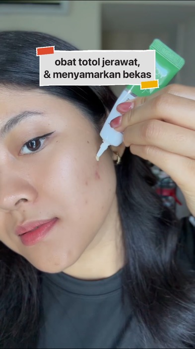 Ampuh lawan bakteri penyebab jerawat, samarkan noda, & nenangin jerawat yang lagi parah2nya 💚 @youbeautyofficial #obattotoljerawat #youacneplus #you