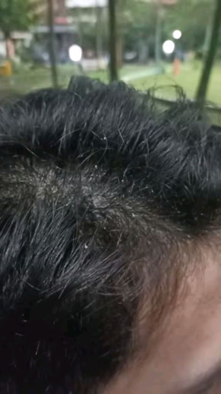 ✨Rambut sehat dimulai dari perawatan yang tepat. Ivogry hadir untuk kamu yang ingin tampil percaya diri setiap hari! 💆‍♀️🌿