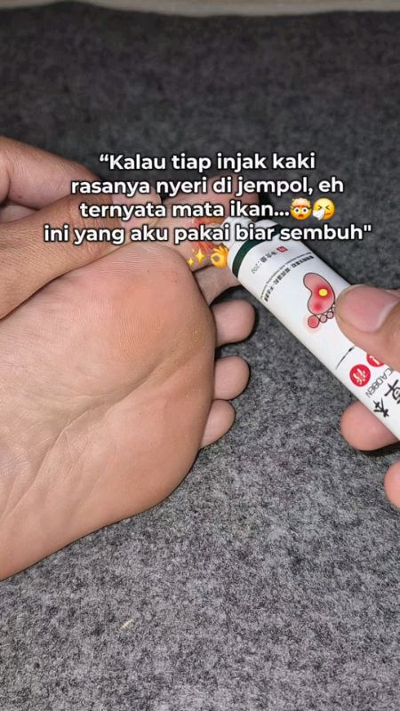 jangan skip salep mata ikan ini #salepmataikan #mataikan #mataikanmeresahkan #RacunShopee #ViralDiShopeeVideo #viralvideo