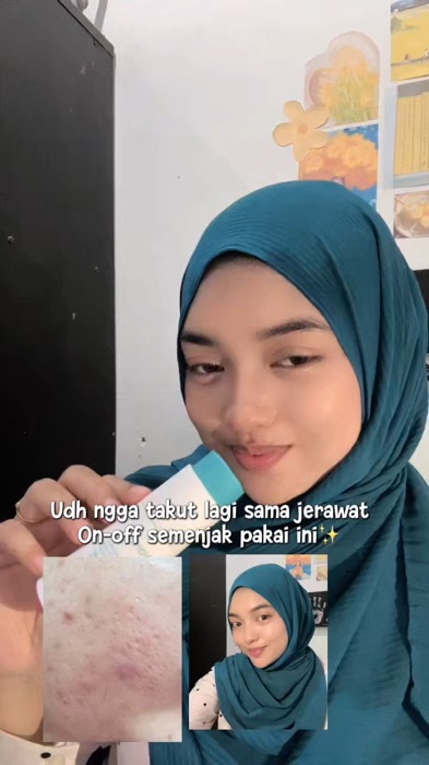 Serum acne andalan aku dari @Wardah Beauty Official  #acneserumera #serumwardahacne #serumjerawat #wardah #serum