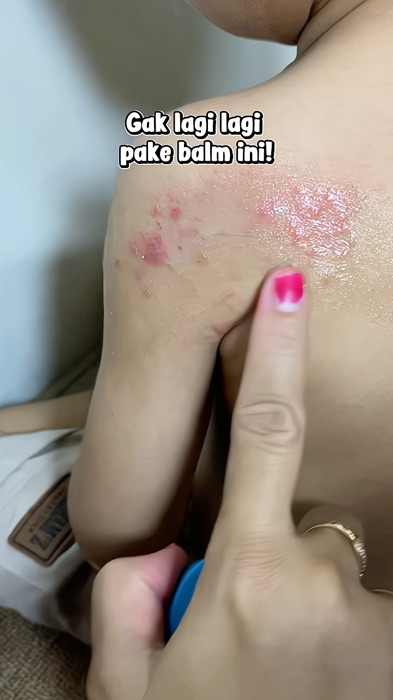 #SpillRacunShopee #SpillBawaBerkah #DiskonRacunShopee #Diskon50Persen #hibooallpurposebabybalm #hiboobabybalm #ruam #ruampopokbayi #bruntusanhilang #b