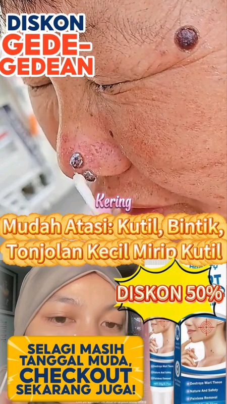 Kutilan Tahi lalat ga usah Kwatir ini Solusinya ♥️#RacunShopee #RacunShopeeCheck #ShopeeVideoCreator #videoshopee #RacunShopeeUnik #ViralDiShopeeVideo